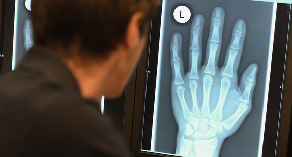 Ein Radiologe schaut im Röntgenbild die linke Hand eines 17-Jährigen an.