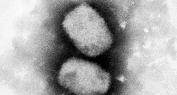 Elektronenmikroskopische Aufnahme des Affenpockenvirus