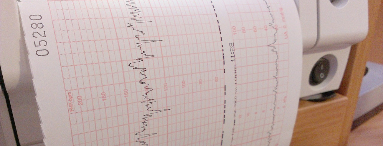 Maschine zeichnet Herzschlagrate auf