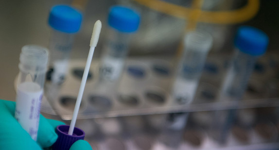 Eine Mitarbeiterin des Landesgesundheitsamts Baden-Württemberg hält Abstrich eines Covid-19 Verdachtsfalles in der Hand.