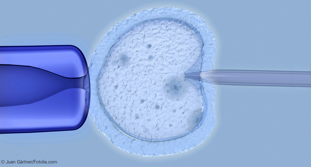 In-vitro-Fertilisation